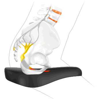 sqlabergonomiebeckensattelschmerzenzustufensattelMannSeite