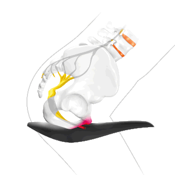 sqlabergonomiebeckenfraufalschesattelformzustufensattel612
