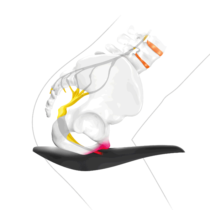 sqlabergonomiebeckenfraufalschesattelformzustufensattel612