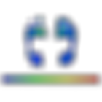sqlab.studie.druckmessung.fuss.Druckmessbild.2020.Sohle.SQlab.high