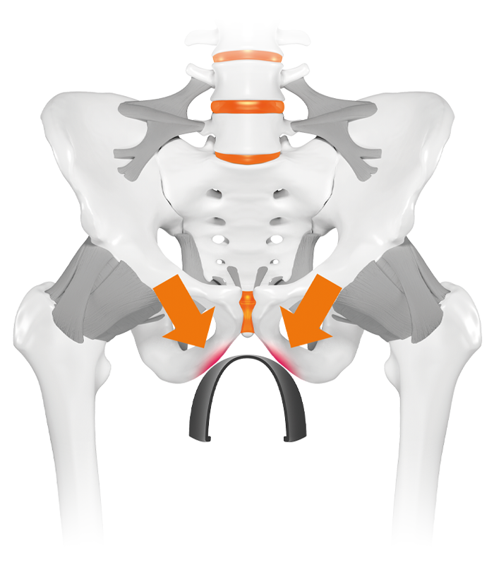 Pelvis, Pressure pubic arch or genitals while cycling, Saddle